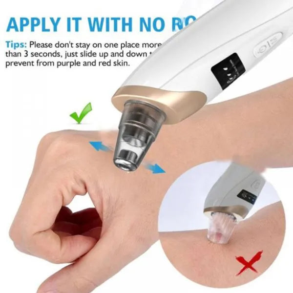 Electric Suction Blackhead Pore Cleaner