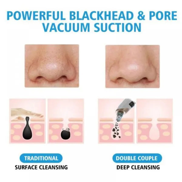 Electric Suction Blackhead Pore Cleaner