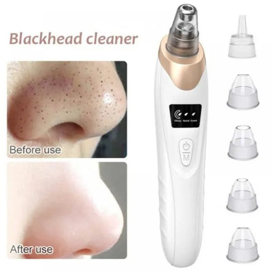 Electric Suction Blackhead Pore Cleaner